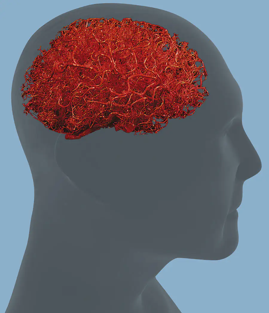 Vascular - Circulación Cerebral, aspecto visual del producto relacionado con la salud cerebral.